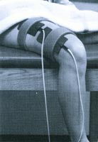 stim